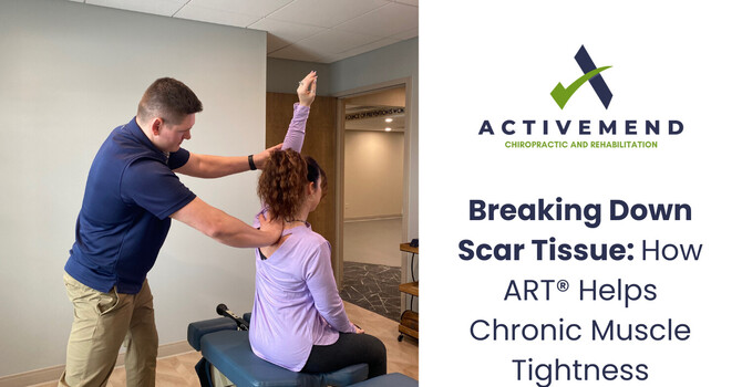 Breaking Down Scar Tissue: How ART® Helps Chronic Muscle Tightness image
